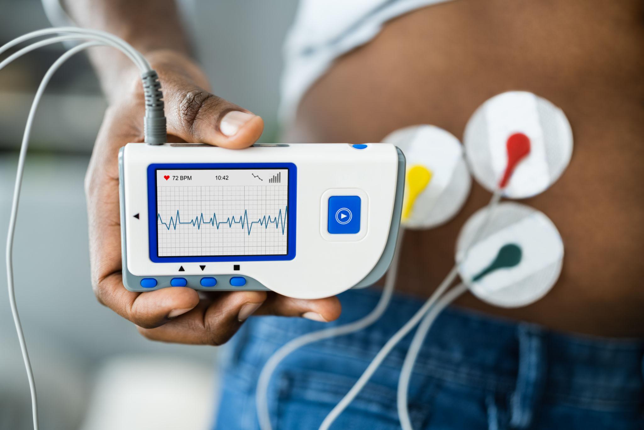 ECG machine